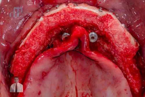 Carousel post from imperio_director.