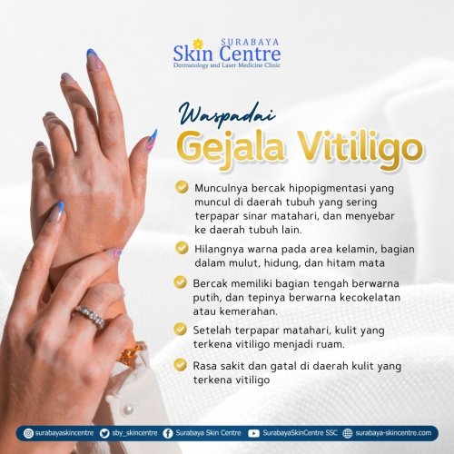PostPhoto