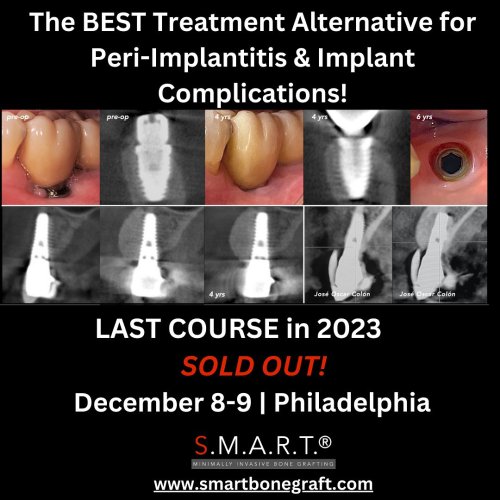 Photo post from smartbonegraft.