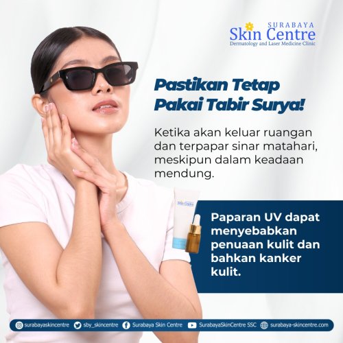PostPhoto