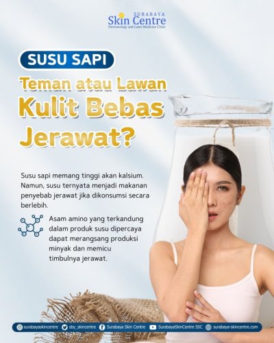 PostPhoto