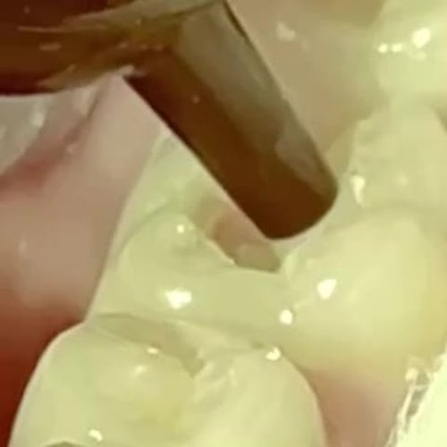 Video post from trilliumdental.