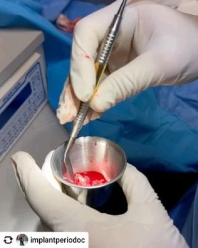 Video post from geistlich_north_america.