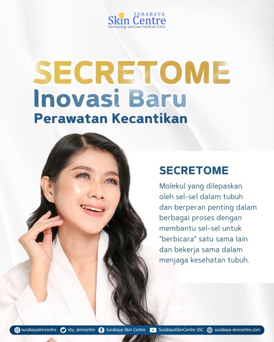 PostPhoto