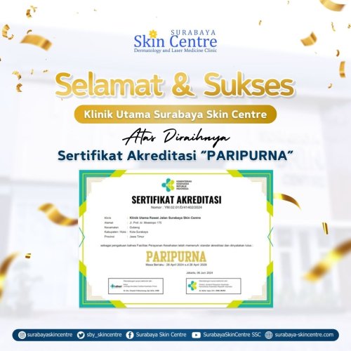 PostPhoto