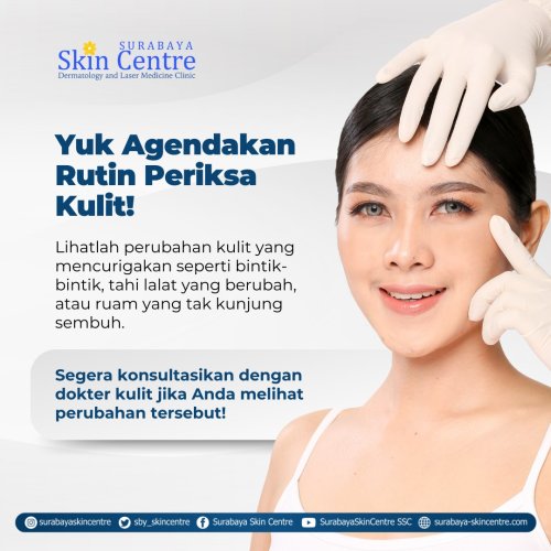 PostPhoto
