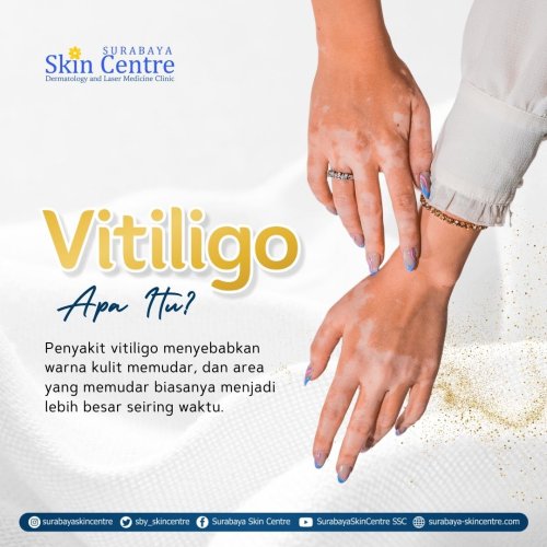 PostPhoto