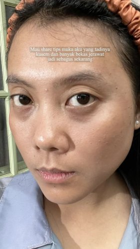 PostPhoto