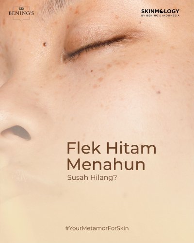 PostPhoto