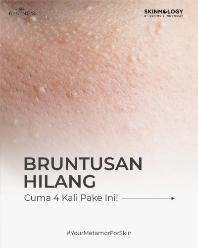PostPhoto