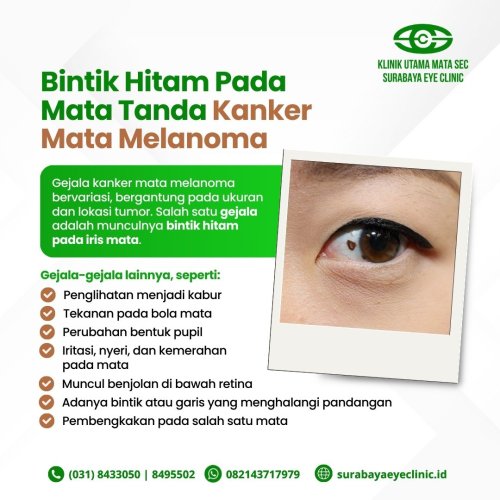 PostPhoto