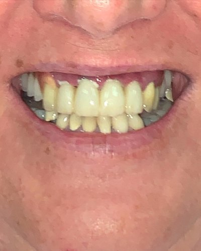 Carousel post from dentalimplantjedi.