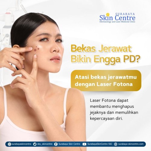 PostPhoto