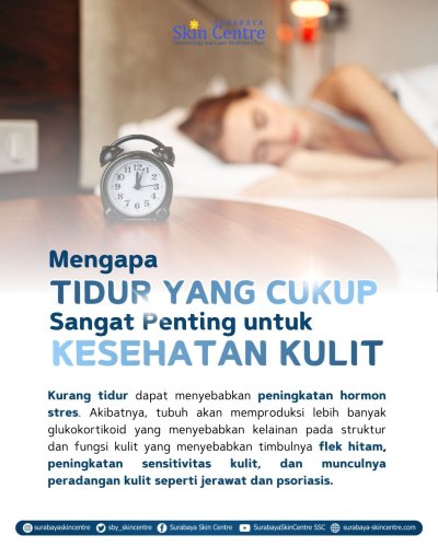 PostPhoto