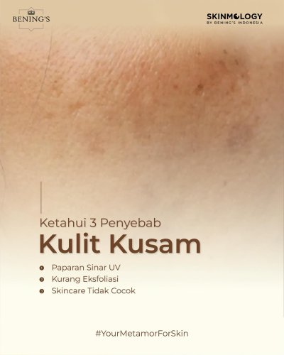 PostPhoto
