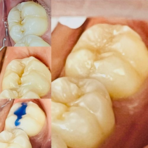 Photo post from trilliumdental.