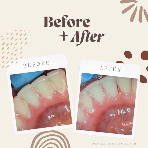 Photo post from trilliumdental.