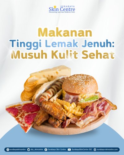 PostPhoto