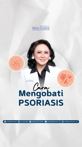 PostPhoto
