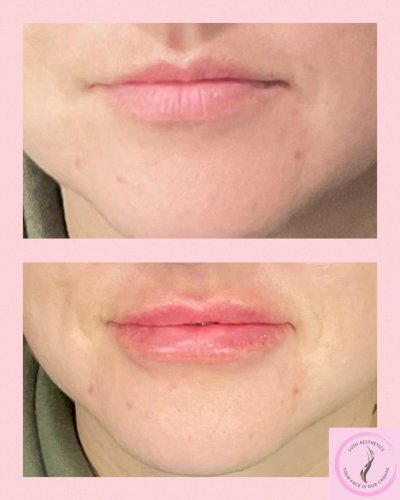 Photo post from lushaestheticsky.