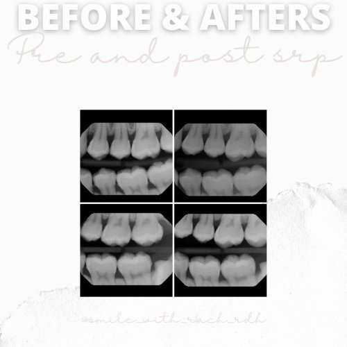 Carousel post from trilliumdental.