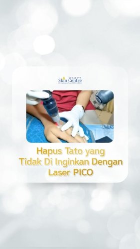 PostPhoto
