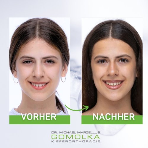Photo post from dr.gomolka.