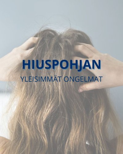 PostPhoto