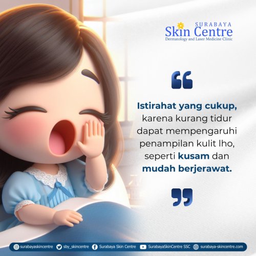 PostPhoto