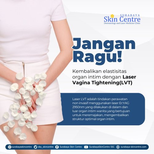 PostPhoto