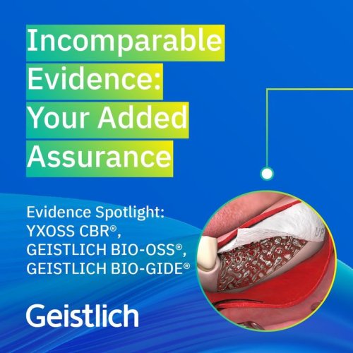 Carousel post from Geistlich Biomaterials - North America.