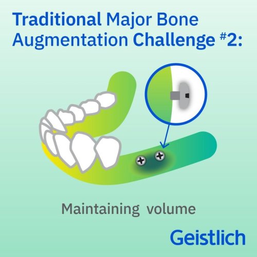 Photo post from Geistlich Biomaterials - North America.