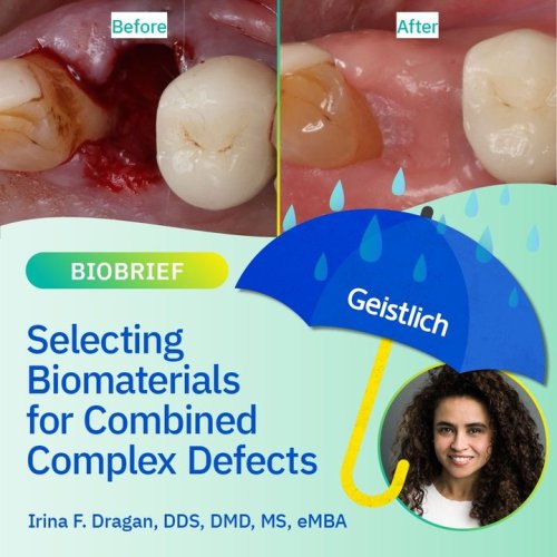 Carousel post from Geistlich Biomaterials - North America.