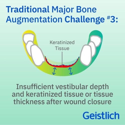 Photo post from Geistlich Biomaterials - North America.
