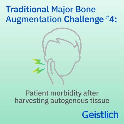 Photo post from Geistlich Biomaterials - North America.