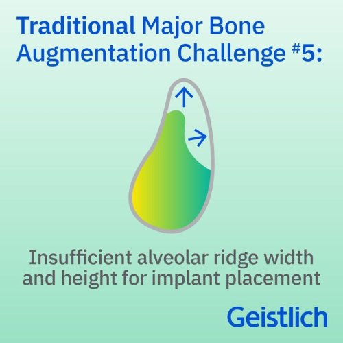 Photo post from Geistlich Biomaterials - North America.