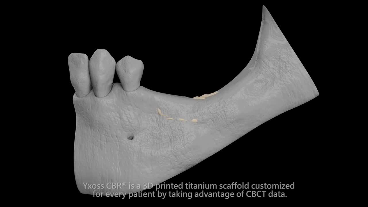 Video post from Geistlich Biomaterials - North America.