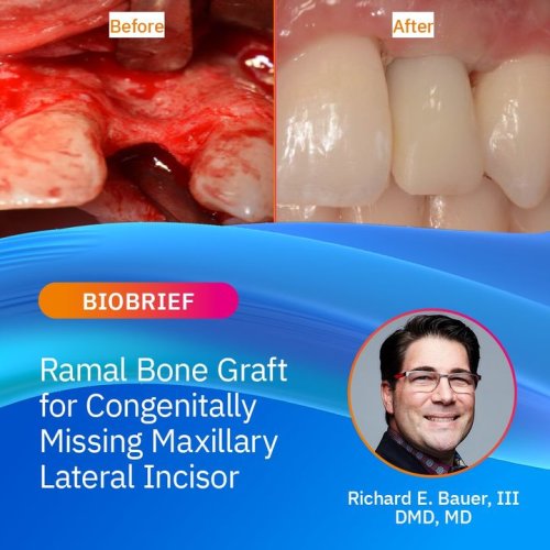 Carousel post from Geistlich Biomaterials - North America.