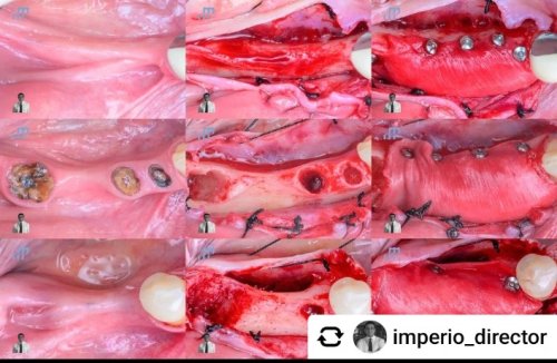 Carousel post from Geistlich Biomaterials - North America.