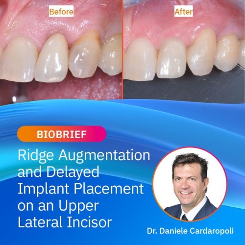 Carousel post from Geistlich Biomaterials - North America.
