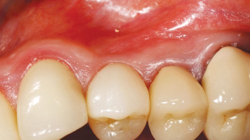 Photo post from Geistlich Biomaterials - North America.