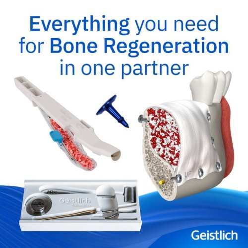 Photo post from Geistlich Biomaterials - North America.