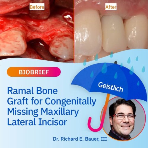 Carousel post from Geistlich Biomaterials - North America.