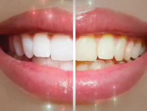 Video post from Tandläkare Katrin Onno.